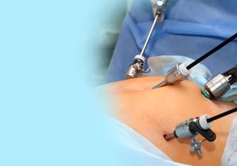 Laparoscopic Surgery Services